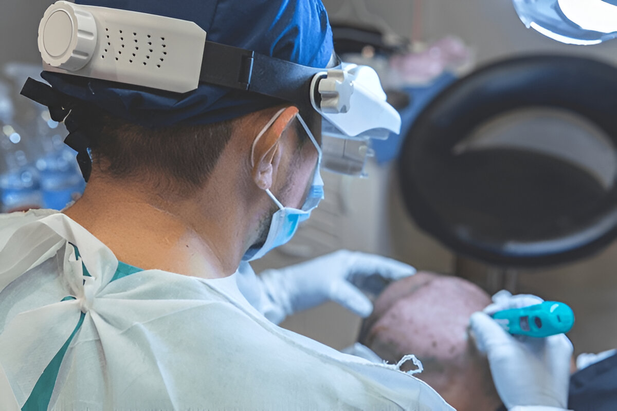 Hair Transplant