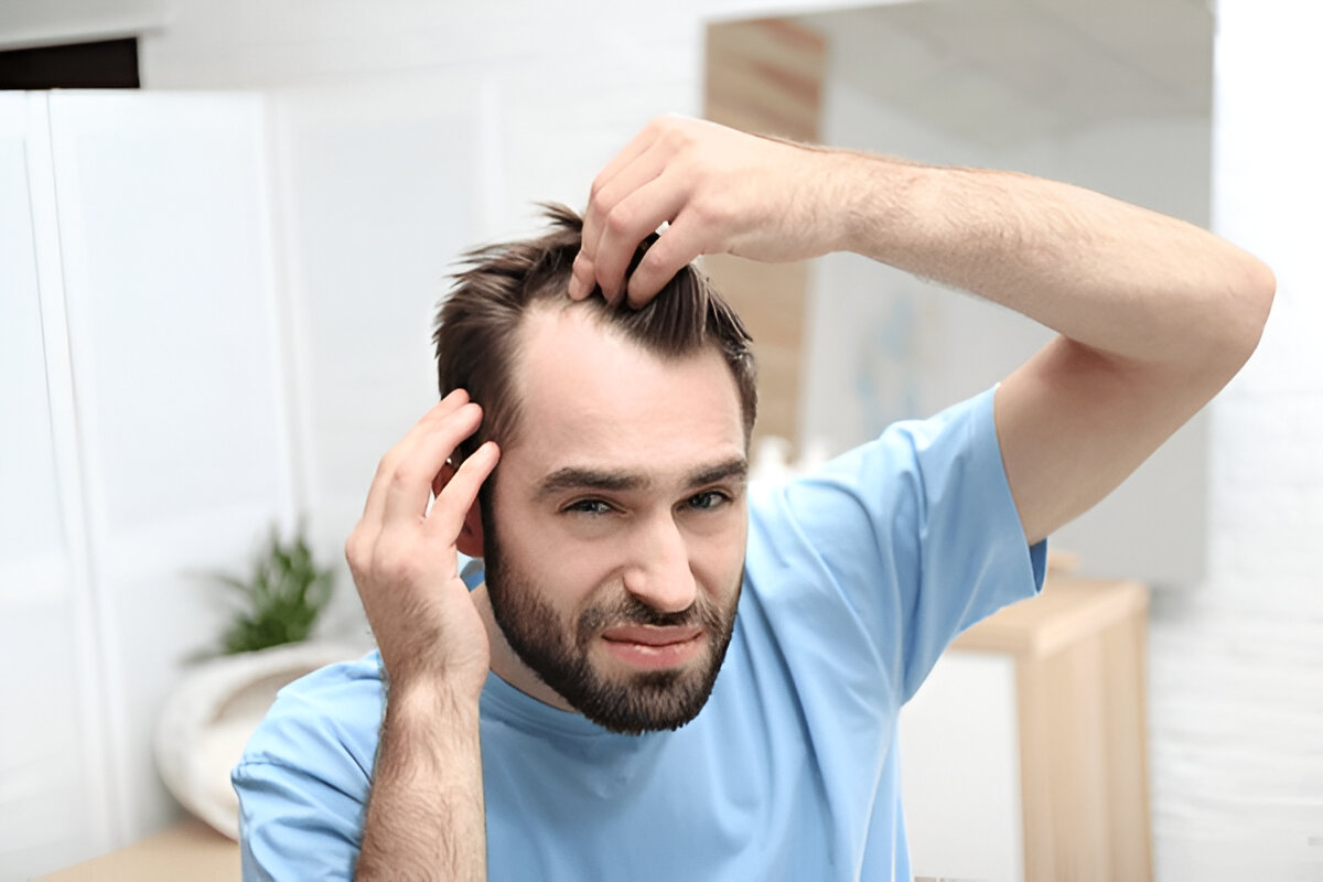 Do Hair Transplants Really Work for Receding Hairlines?