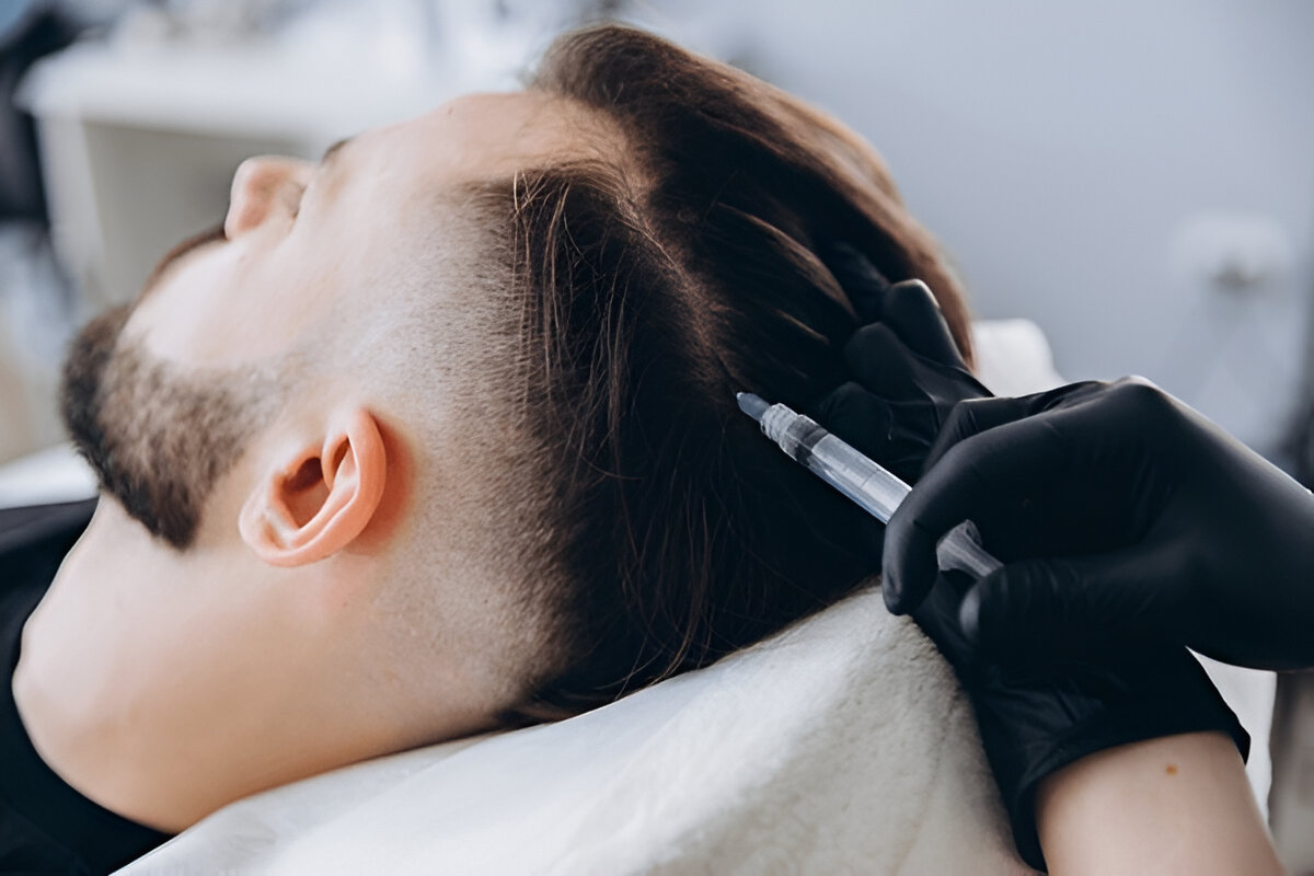 Hair Transplant