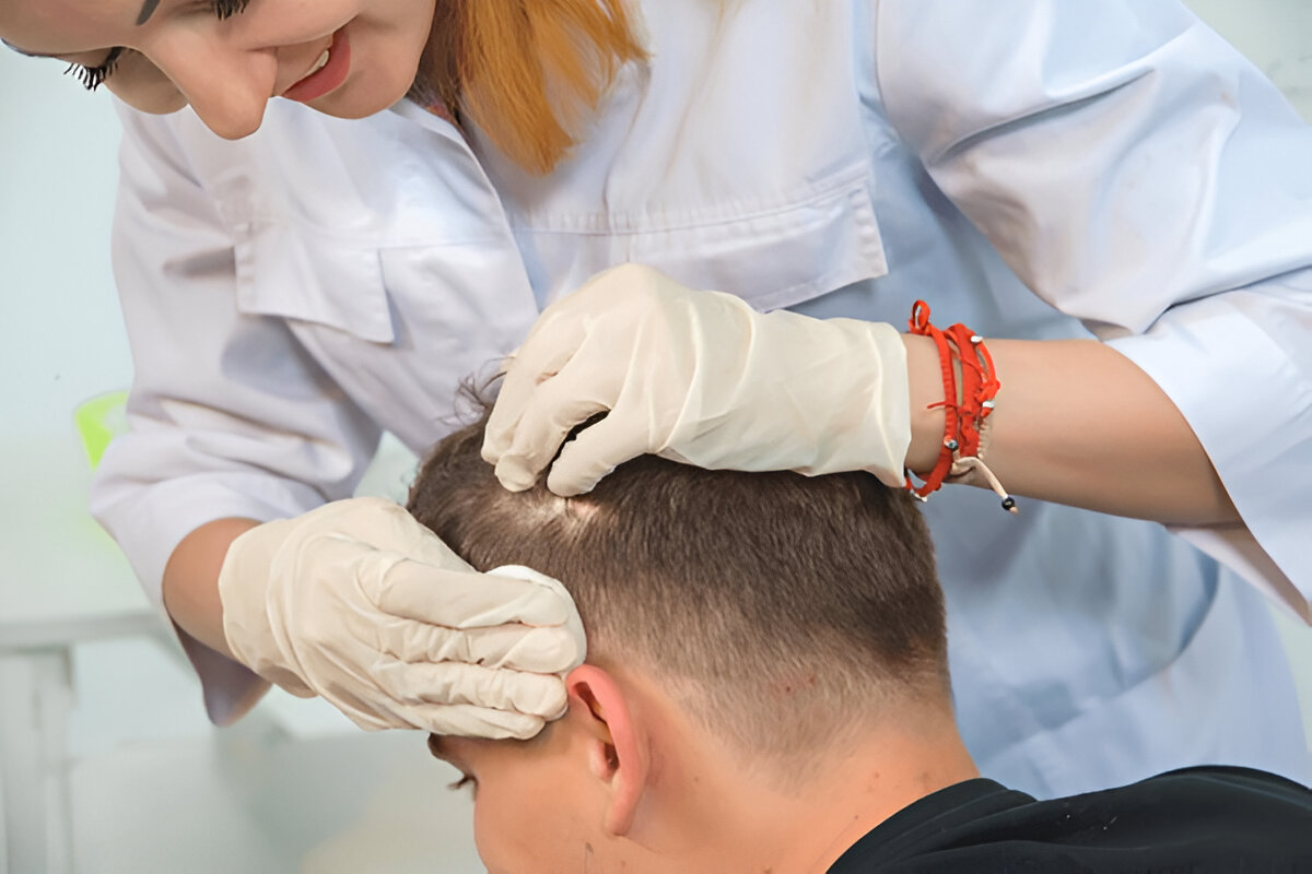 London hair transplant
