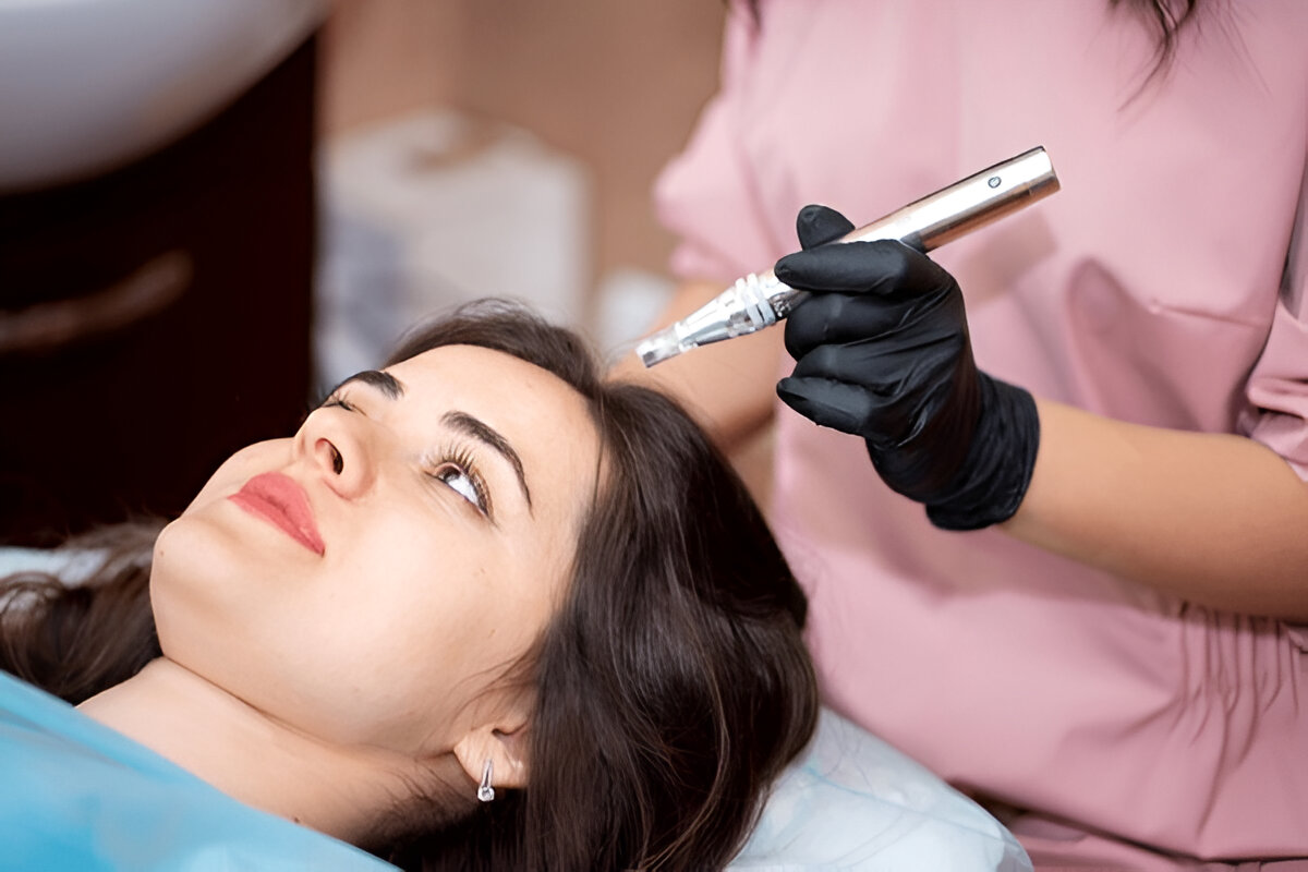 hair transplant